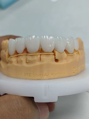 購入 5mm-6mm 層状ジルコニア・クラウン 強度 ジルコニア・クラウン 多層 online manufacture