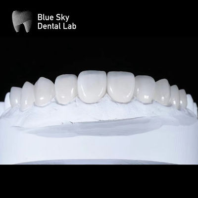 購入 スリーク・プレミアム・ファニヤ・ケース 0.3mm 超薄エマックス・ファニヤ online manufacture