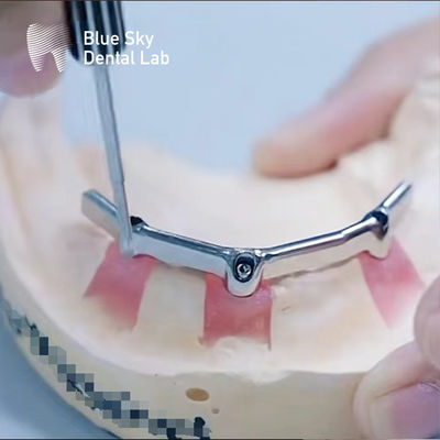 購入 精密歯科 宝石付付チタン棒 生物互換性 online manufacture