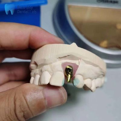 購入 通常のインプラントケース 単体インプラント 歯のインプラントケース online manufacture