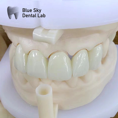 購入 自然エステティック 多層ジルコニアクラウン 高強度 化学耐性 online manufacture