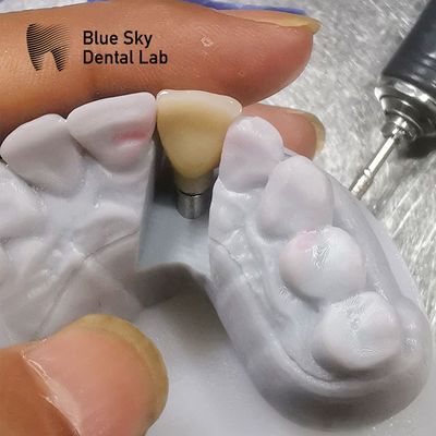 購入 生物相容性研究 植入シナリオ 蒸気消毒 online manufacture