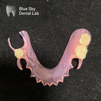 購入 パーソナライズ 取れるアクリル部分歯入れ 自然に見える バルプラスト部分歯入れ online manufacture