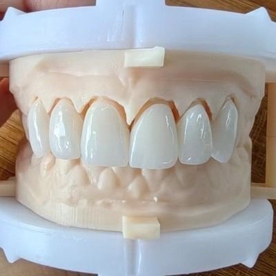 購入 美しい笑顔と良い復元のために自然美学層ジルコニアの王冠橋 FDAとCE認証 online manufacture