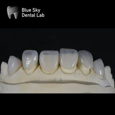 超薄スリーク・ファニヤケース 0.3mm 最薄のカスタム・ファニヤ