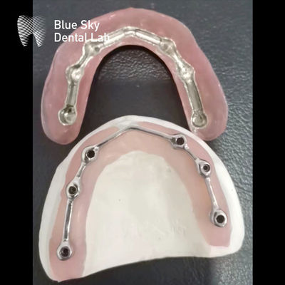 歯科用チタンバー 歯科インプラント用チタンバー