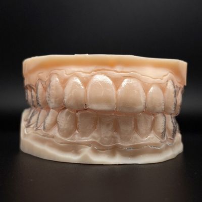 パーソナライズ可能な歯 透明なアライナー 治療時間が短く 透明なブラシ